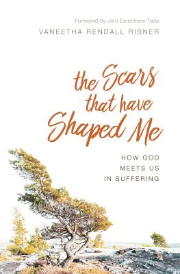 Image of The Scars That Have Shaped Me: How God Meets Us in Suffering other